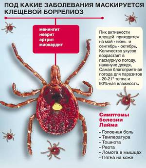 Что такое болезнь Лайма и как ее определяют