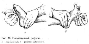 Подошвенный рефлекс и его проявления