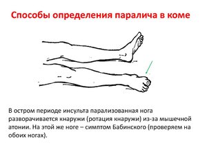 Обследование пациента, который находится в коме