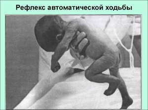 Рефлекс у новорожденного